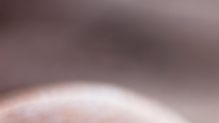 Cómo aliviar quemaduras con papas crudas