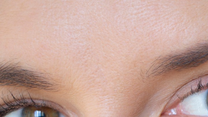 Cómo eliminar las ojeras con bicarbonato