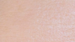 Cómo eliminar las ojeras con bicarbonato