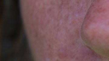 Por qué se mancha el área del bigote