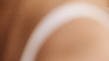 sábila para reducir las estrías