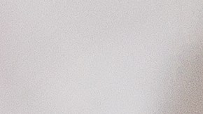 Las serias desventajas de usar tanga o hilo dental tan seguido