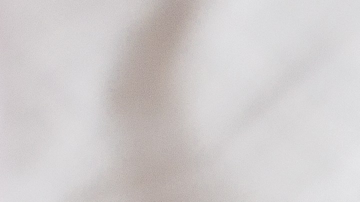 Las serias desventajas de usar tanga o hilo dental tan seguido