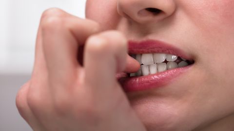Hábitos que pueden dañar tus dientes.