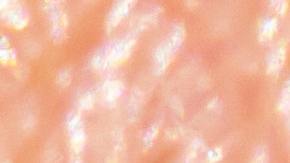 me mordió una garrapata