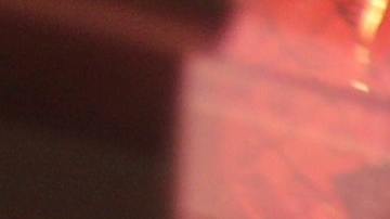 superbacterias resistentes a antibióticos más comunes en productos cárnicos