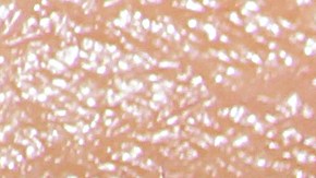 Cómo puedes contraer caries a través de un beso.