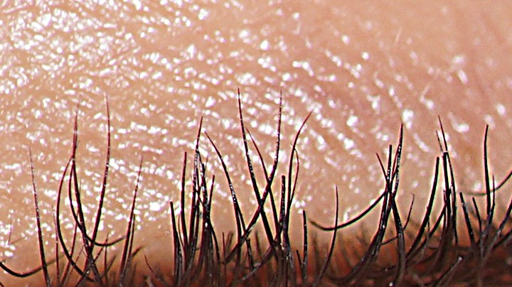 Cómo puedes contraer caries a través de un beso.