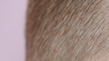 efectos secundarios de tomar multivitamínicos