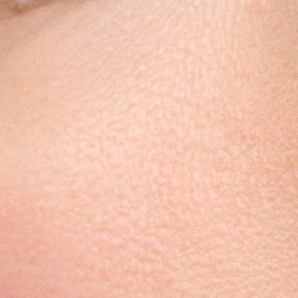arrancarte la piel de los labios