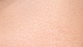 arrancarte la piel de los labios
