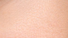 arrancarte la piel de los labios