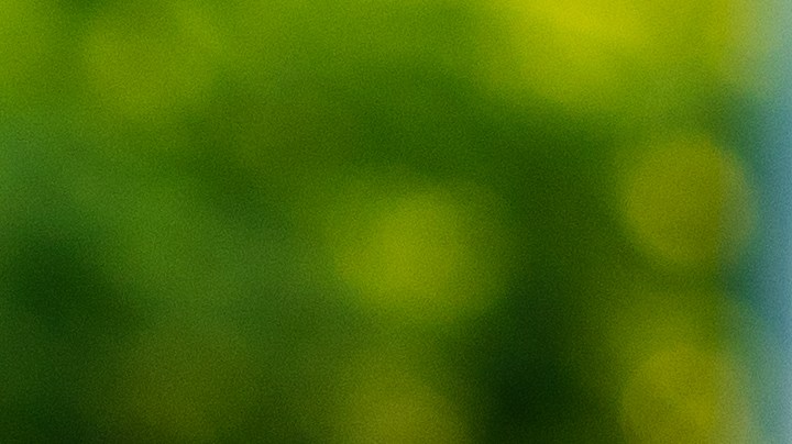 Signos severos de las picaduras de insectos.