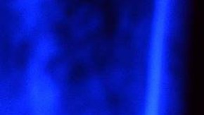 Lisa Marie Presley complicación bariátrica