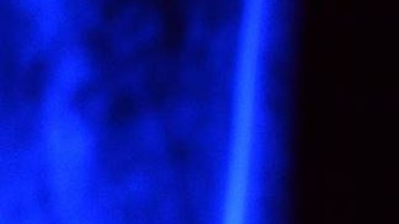 Lisa Marie Presley complicación bariátrica