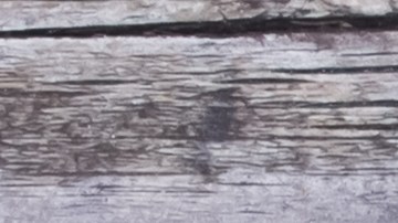 Cuáles son los alimentos que eliminan la celulitis.