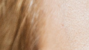 diagnosticada con demencia