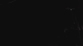 HIIT complicaciones posoperatorias