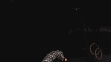 HIIT complicaciones posoperatorias