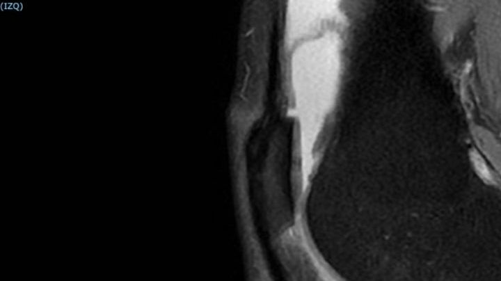 Las consecuencias, buenas y malas, tras correr todos los días durante 3 años y 21 días