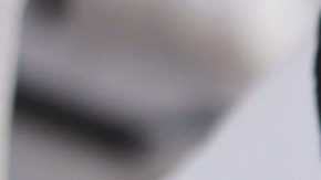 antes de ponerte rellenos en la cara