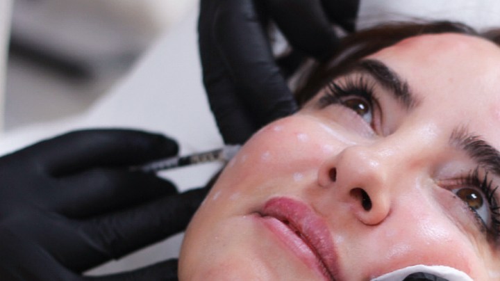 antes de ponerte rellenos en la cara