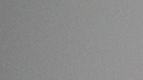 Qué hacer ante una infección por hongos en las axilas.