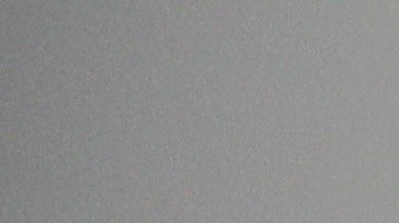 Qué hacer ante una infección por hongos en las axilas.