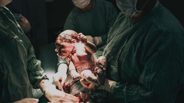 embarazada tras una cesárea