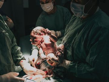 embarazada tras una cesárea