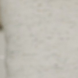 COVID aumentaría el riesgo de diabetes tipo 1 en los niños