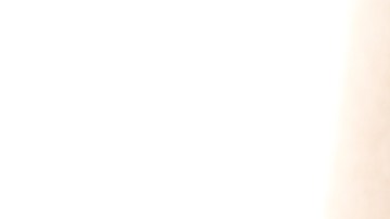 Cómo eliminar el acné en los glúteos.