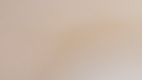 Eliminar lunares con ajo en Hacks para estar mejor.