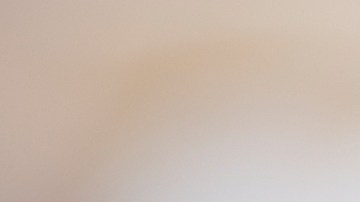 Eliminar lunares con ajo en Hacks para estar mejor.