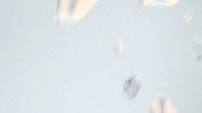 Cuál es el signo de depresión que no debes ignorar, según expertos.