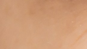 Remedios caseros que puedes aplicar para curar un afta.