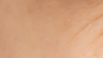 Remedios caseros que puedes aplicar para curar un afta.