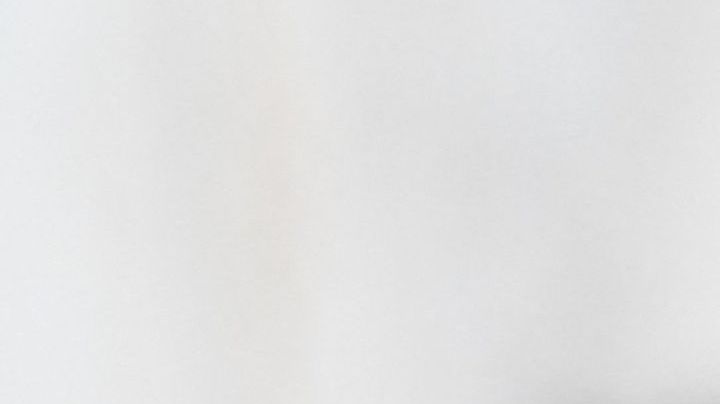 Síndrome de persona rígida: El espectro con el que lucha Celine Dion