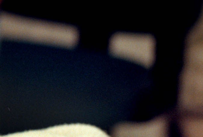 Cirugía de orejas: una de las principales operaciones estéticas en EE.UU.