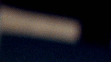 Cirugía de orejas: una de las principales operaciones estéticas en EE.UU.