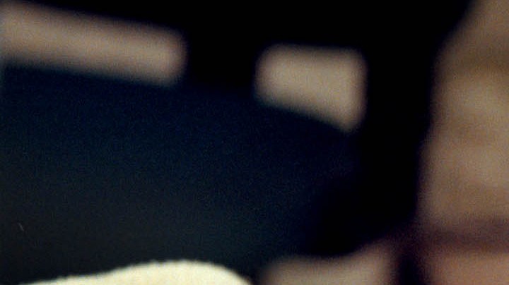 Cirugía de orejas: una de las principales operaciones estéticas en EE.UU.