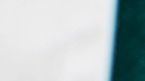 Nefrólogo revela el mejor método para saber si tus riñones funcionan correctamente.