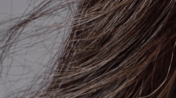 cuello dolor
