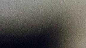 Cómo saber si debes ir al médico por cálculos renales.