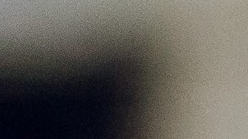 Cómo saber si debes ir al médico por cálculos renales.