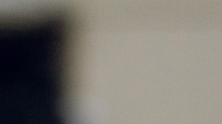 Cómo saber si debes ir al médico por cálculos renales.