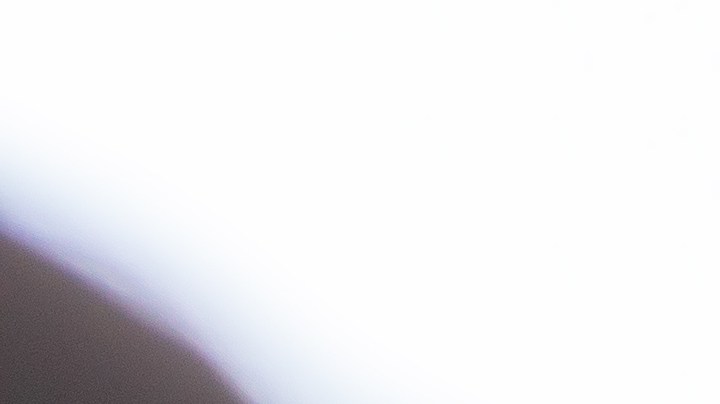 Hacks para Estar Mejor: Trucos para eliminar la caspa y cuero cabelludo seco