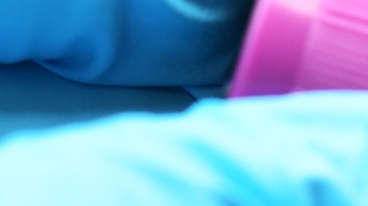 Expertos aclaran qué significa tener la creatinina baja.