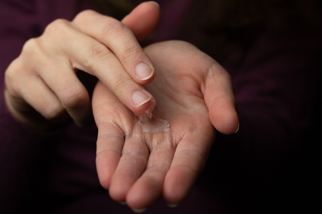 Cómo curar las manos resecas usando aceites naturales.