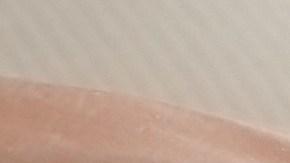 Claves para reconocer un aborto espontáneo con solo dos síntomas